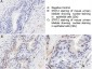 Anti-STAT2 pY690 (RABBIT) Antibody